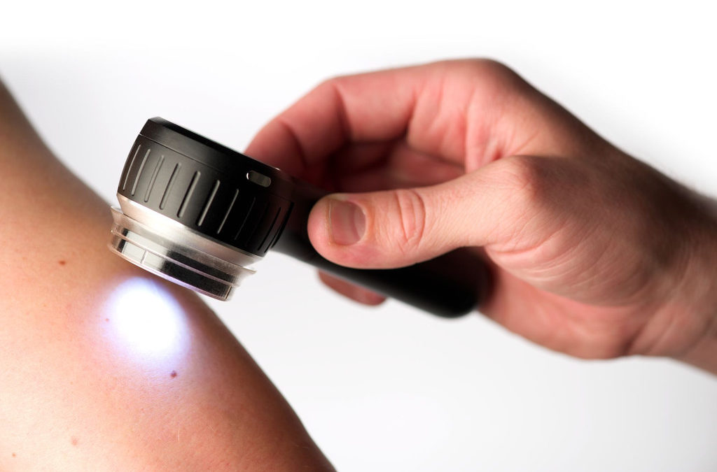 Curso de Dermatoscopía