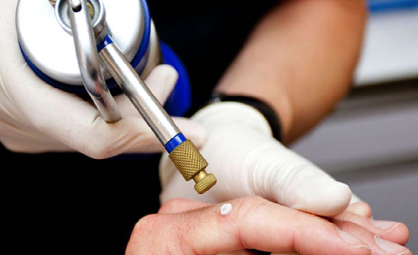 Taller de Criocirugía Teórico Práctico