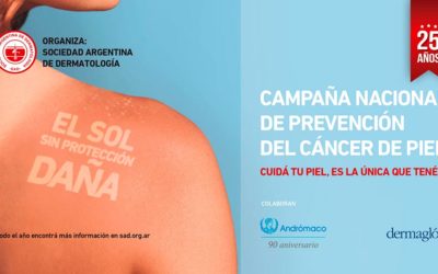 Campaña Nacional de prevención de Cáncer de Piel