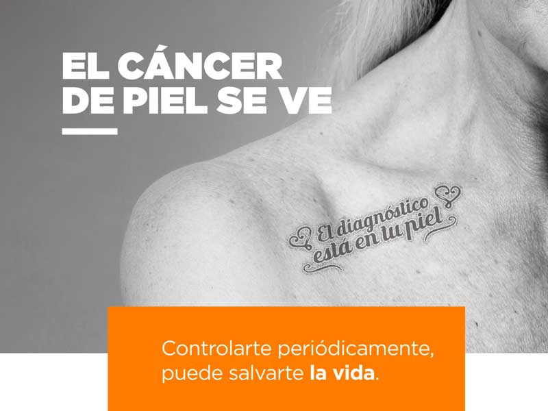 Campaña de Cáncer de piel