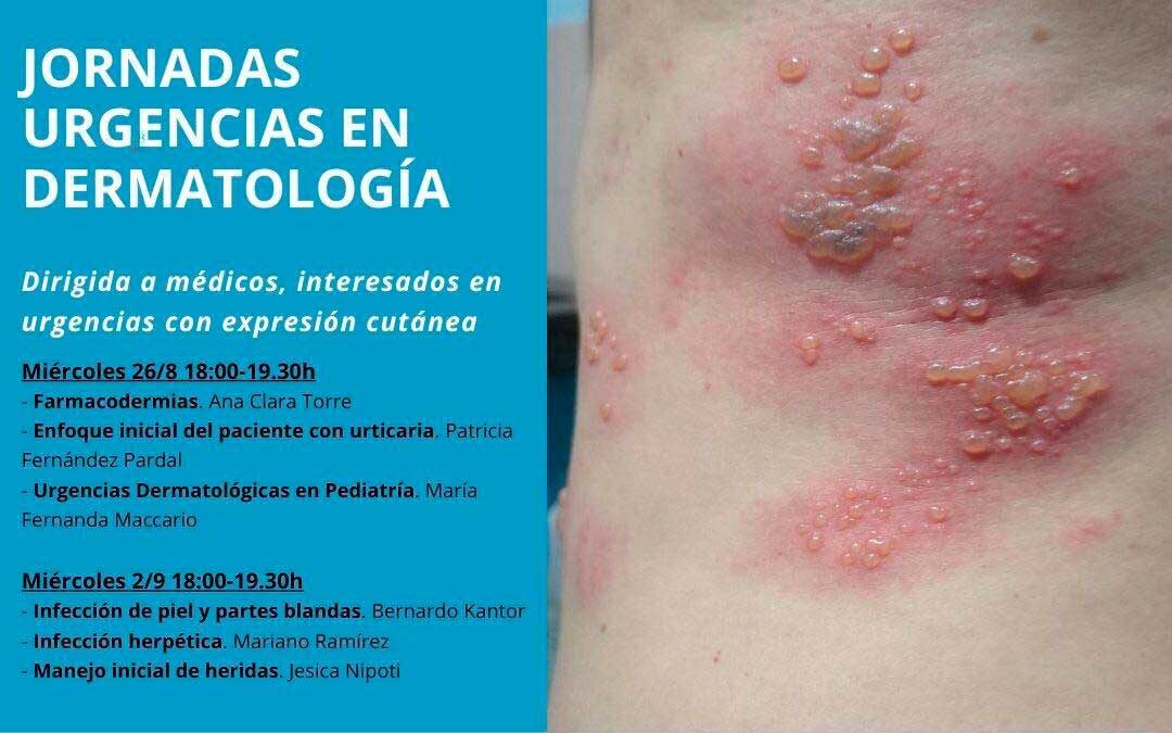 Jornadas gratuitas de urgencias en dermatología