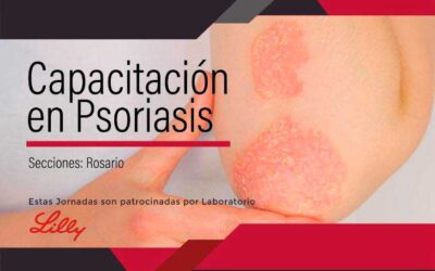 Capacitación Psoriasis