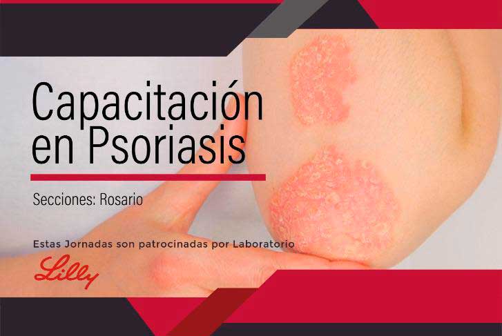 Capacitación Psoriasis