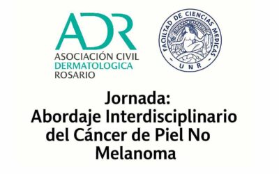 Jornada: Abordaje Interdisciplinario del Cancer de Piel No Melanoma